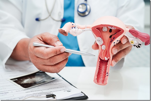 Uterus, doctor holding human anatomy model for study diagnosis and treatment in hospital.